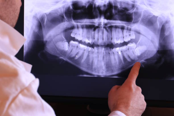 Best Emergency Dental Care for Trauma or Injury in Mountain Home, NC